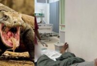Keterangan Foto: Korban Hamra Saat Tengah Menjalani Perawatan di RSUD Komodo.
