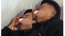 Warga Kota Ruteng Diduga Dianiaya Oknum Polisi, Keluarga Lapor ke Polres Manggarai