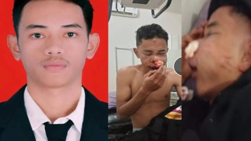 Oknum Polisi Manggarai Diduga Aniaya Pemuda hingga Kritis, Netizen: “Jangan Mau Damai!”