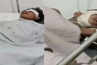 Dua Warga Asal NTT Babak Belur Dihajar Massa Gegara Nekat Curi Sepeda Motor Honda Beat