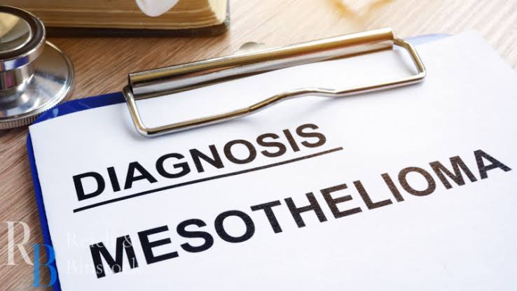 Kasus-Kasus yang Ditangani Pengacara Mesothelioma di Amerika Serikat: Keadilan bagi Korban Paparan Asbes