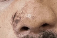 Guru SD di Manggarai Barat Dikeroyok Tujuh Warga Setelah Menegur Anak Main Petasan