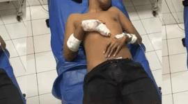 Penganiayaan Terjadi di Bali  Jelang Tahun Baru 2026: Mahasiswa NTT Ditikam Pakai Tombak Gegara Kembang Api