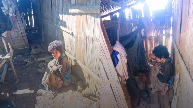 10 Tahun Terbaring Lumpuh, Olivia Piang Tinggal di “Kandang”, Butuh Uluran Tangan

Manggarai Timur – Nasib pilu dialami Olivia Piang (34), warga Kampung Naju, Desa Teno Mese, Kecamatan Elar Selatan, Kabupaten Manggarai Timur, Nusa Tenggara Timur. Selama hampir 10 tahun terakhir, ia terpaksa tinggal di sebuah bilik kayu sempit menyerupai kandang di samping rumah keluarganya akibat kondisi lumpuh total yang dideritanya.

Kondisi ini bukan tanpa alasan. Keterbatasan fisik membuat Olivia tidak mampu berjalan, sehingga keluarga membangun tempat sederhana tersebut agar memudahkan aktivitas sehari-harinya, termasuk buang air besar.

Berdasarkan informasi yang dihimpun, Olivia awalnya terlahir dalam kondisi normal dari pasangan Damianus Lomes dan Marta Deda (almarhumah). Namun, sejak usia sekitar 10 tahun, ia mulai mengalami gangguan kejiwaan. Kondisinya semakin memburuk saat menginjak usia 15 tahun hingga akhirnya mengalami kelumpuhan total.

Kini, di usia 34 tahun, Olivia hanya bisa menghabiskan hari-harinya di dalam bilik kayu tersebut. Ia dirawat oleh saudaranya, Petrus Basar, sementara sang ayah tinggal terpisah di rumah lain.

“Kadang dia tidak makan seharian kalau keluarga sedang ke kebun atau ada keperluan di luar. Dia tidak bisa ke mana-mana karena tidak bisa berjalan,” ungkap salah satu anggota keluarga, Jumat (24/4/2026).

Selama hampir satu dekade, Olivia juga tidak pernah keluar rumah. Kondisi psikologisnya disebut semakin memburuk, dipicu rasa malu akibat keterbatasan fisik yang dialaminya.

Padahal, sebelum sakit, Olivia dikenal sebagai pribadi yang ramah dan mudah bergaul. Ia sering berinteraksi dengan teman-temannya dan dikenal ceria. Namun, perubahan drastis dalam hidupnya membuat ia semakin menarik diri dari lingkungan sosial.

Dari sisi bantuan sosial, Olivia sebenarnya telah terdaftar sebagai Keluarga Penerima Manfaat (KPM) Bantuan Langsung Tunai (BLT) yang bersumber dari APBDes Desa Teno Mese. Selain itu, ayahnya juga menerima bantuan melalui Program Keluarga Harapan (PKH) serta bantuan sembako dari pemerintah.

Sayangnya, bantuan tersebut dinilai belum mampu memenuhi kebutuhan khusus Olivia, termasuk penyediaan tempat tinggal yang lebih layak dan manusiawi.

Pihak keluarga hanya bisa berharap adanya perhatian dari pemerintah daerah maupun para dermawan untuk membantu meringankan beban yang mereka alami.

“Kami berharap ada bantuan untuk memperbaiki tempat tinggal Olivia supaya lebih layak. Minimal dia bisa hidup lebih manusiawi,” tambah keluarga.

Saat ini, Olivia sangat membutuhkan bantuan berupa pakaian layak, kasur, selimut, pampers dewasa, serta kebutuhan pokok sehari-hari. Selain itu, dukungan untuk renovasi tempat tinggal menjadi kebutuhan mendesak agar ia tidak lagi hidup di tempat yang tidak layak huni.

Kisah Olivia menjadi potret nyata masih adanya warga yang hidup dalam keterbatasan dan membutuhkan perhatian bersama. Uluran tangan dari berbagai pihak diharapkan dapat membantu menghadirkan kehidupan yang lebih layak bagi dirinya.